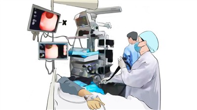 Endoskopiskās gļotādas rezekcijas (EMR) un endoskopiskās submucosal dissekcij...